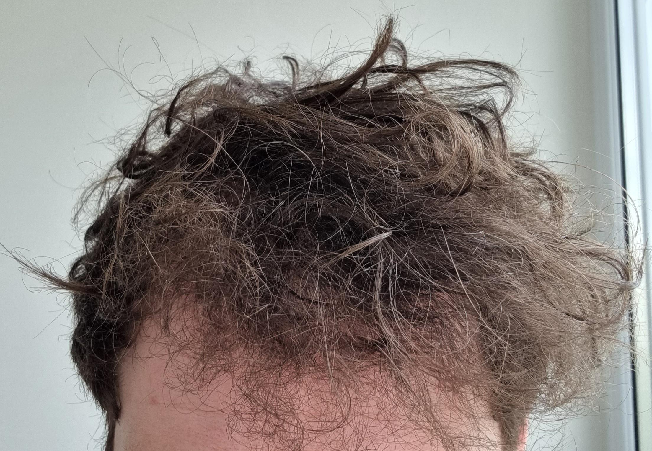 What Does Damaged Hair Look Like?