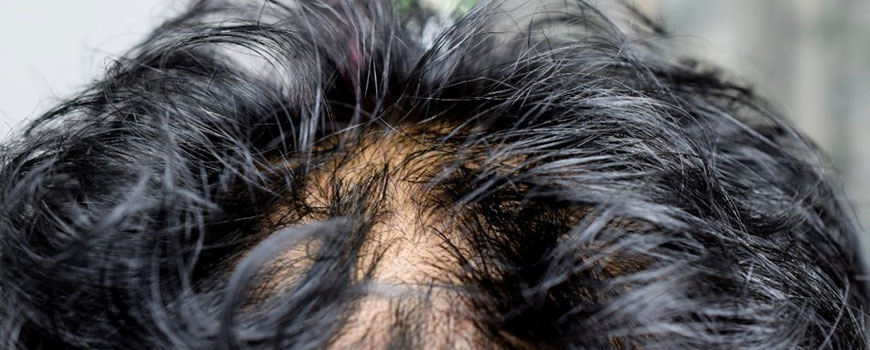 Why Does My Hair Feel Waxy? Understanding the Causes and Finding Solutions